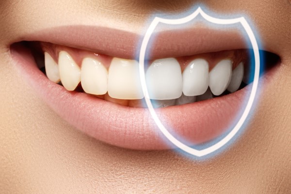 Teeth whitening in Yavatmal.